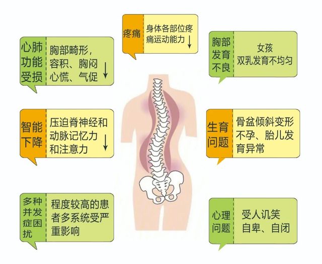 孩子脊柱側(cè)彎與體態(tài)不良背后的健康風(fēng)險(xiǎn)